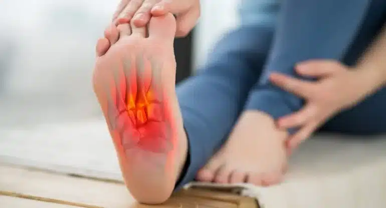 Fascitis plantar