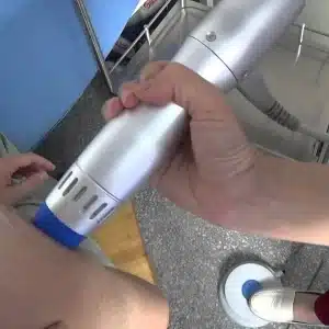Imagen de ondas de choque, un tratamiento no invasivo eficaz para la rehabilitación física.